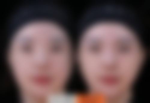 四、宁波海曙澳玛星光悦容整形医院特色项目