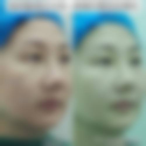 八、东营隋氏医学整形美容门诊部真实的患者评价