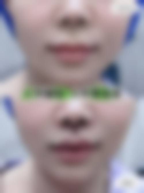 二、周口缔莱美整形医院怎么样?