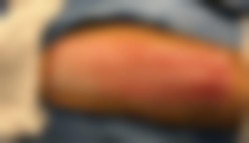 二、淮安俏美整形美容医院怎么样？