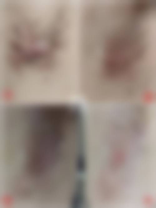 三、宁波海曙澳玛星光悦容整形医院诊疗项目有哪些?