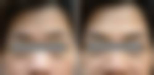 五、武汉阿芙罗医疗美容医院价格表