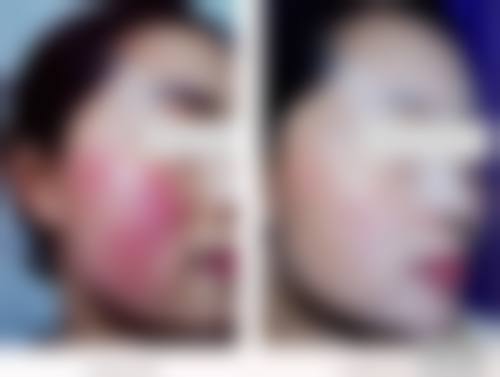 二、贵阳市第一人民医院(烧伤整形科/医疗美容科/创面修复科)怎么样？