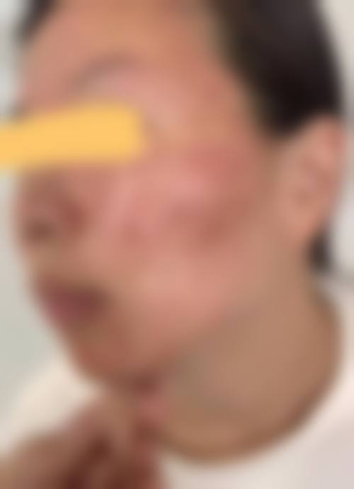 四、东营隋氏医学整形美容门诊部特色项目