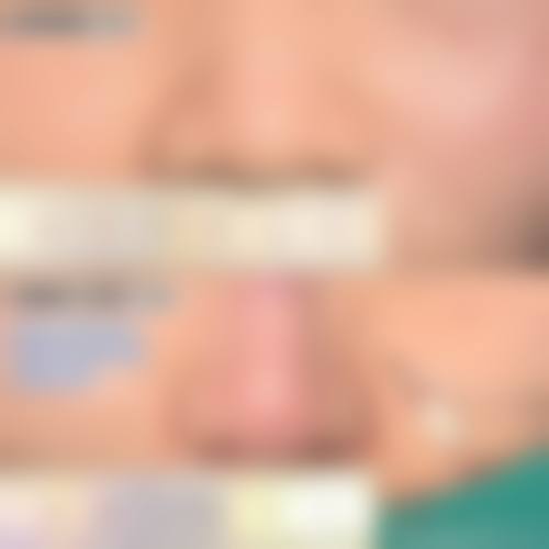 七、福州市前列医院预约方式