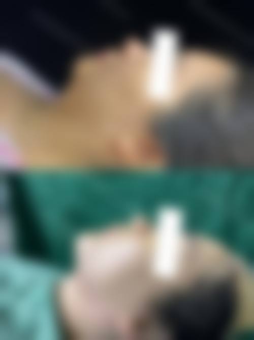 八、唐山颐安娜医疗美容医院真实的患者评价