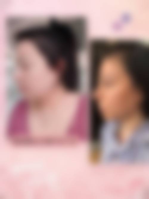 八、郑州丽天整形医院预约方式