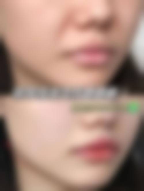 四、哈尔滨千和若美整形美容特色项目