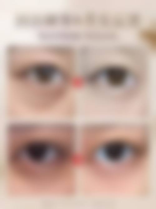 四、泉州康桥医疗美容门诊部特色项目