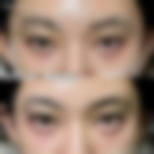 三、上海和睦家新城医院医疗美容科诊疗项目有哪些?