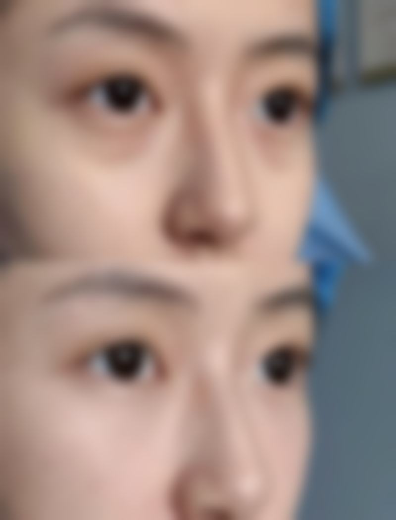 四、经期不同月经量对手术的影响