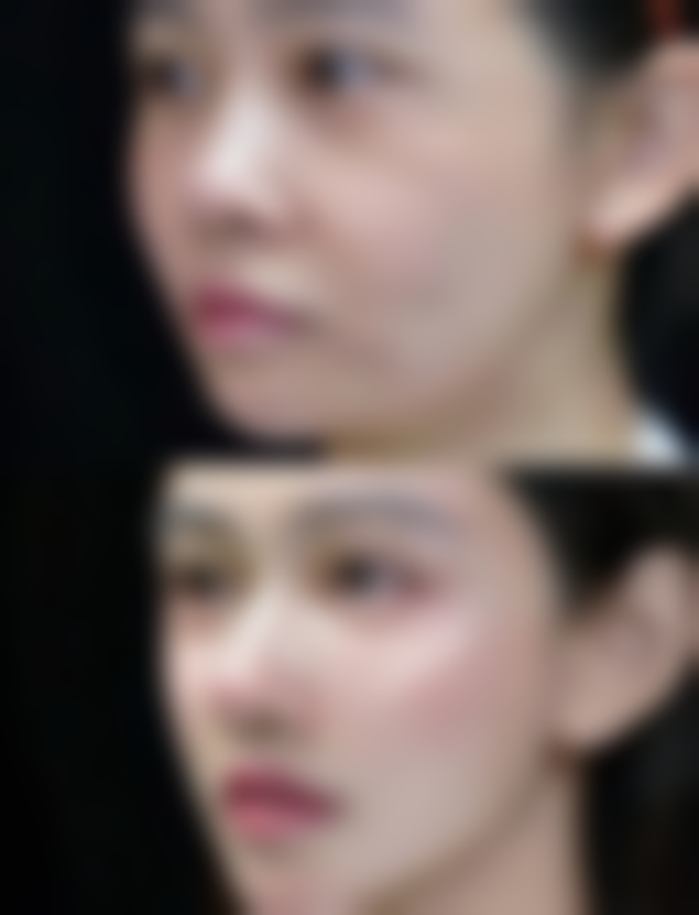 九、周口缔莱美整形医院真实的患者评价