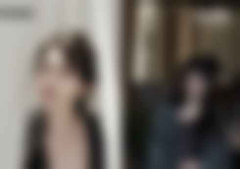 二、为什么经期要避免做双眼皮手术?风险分析