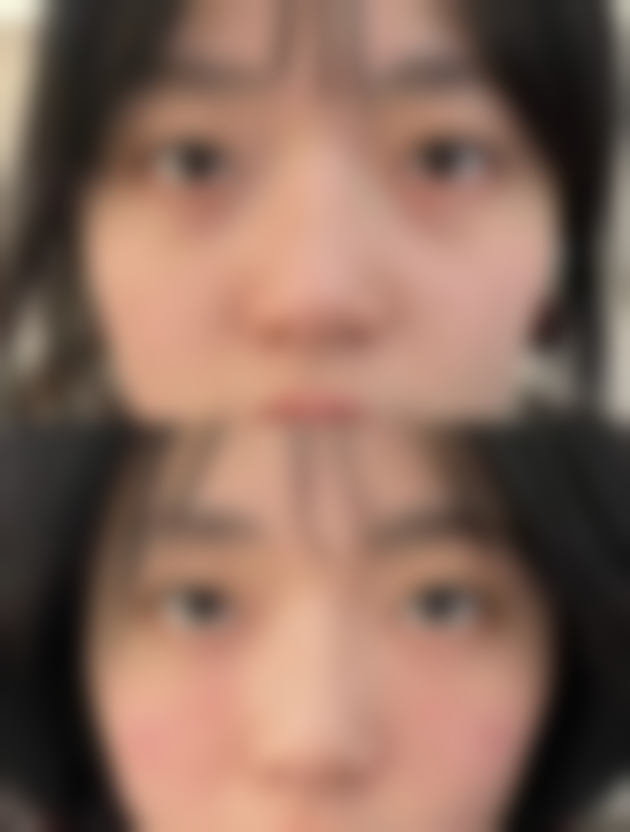 经期可以做双眼皮手术吗?了解经期手术风险与应对建议，安全变美有保障！ 