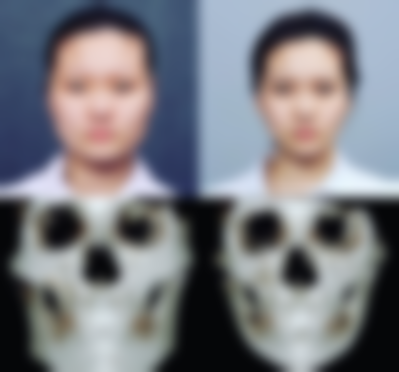 二、泰国TARA整形医院怎么样?