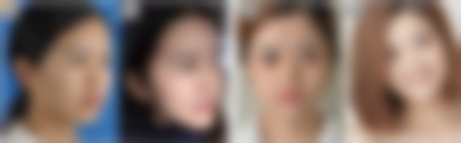 七、南昌爱思特(艾莱芙)美容医院预约方式