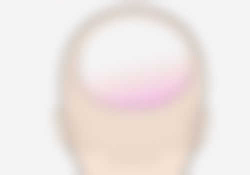 五、何时需要就医