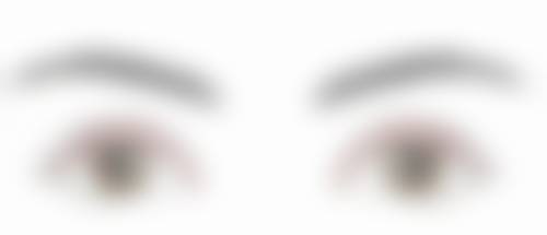 四、针对不同类型眼袋泪沟的解决方案