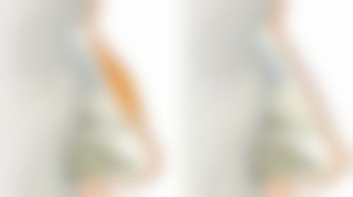 六、美学提示与医美建议