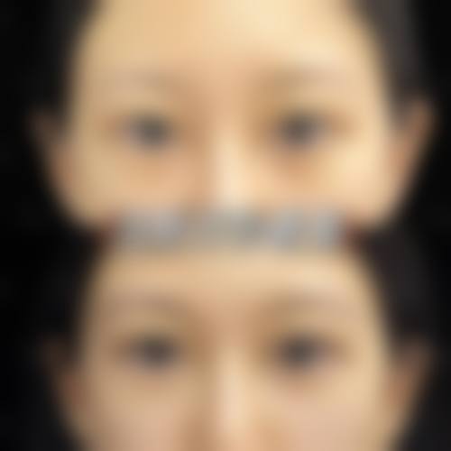 六、凃睿真实的患者评价