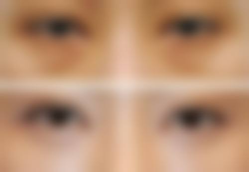 八、山西省太原市杏花岭区娇秀美容院真实的患者评价