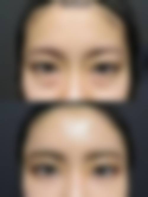 五、中山壹莱美医疗美容诊所价格表