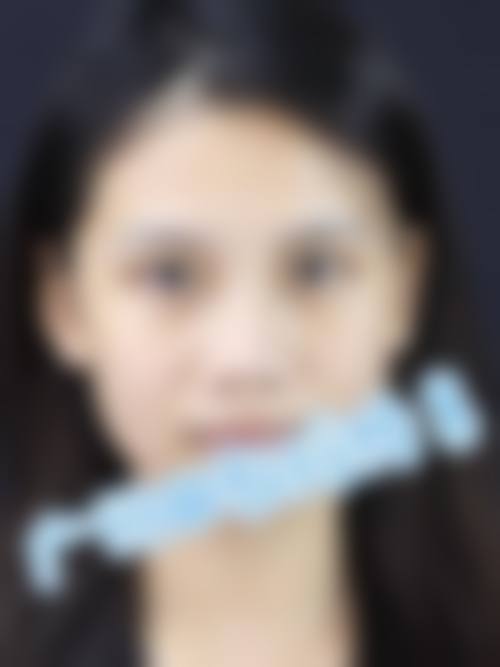 四、深圳天爱医疗美容诊所特色项目