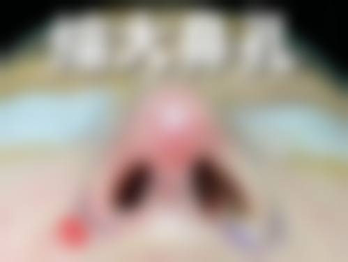 二、青岛正阳春天医学美容医院怎么样?