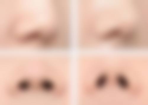 八、青岛正阳春天医学美容医院预约方式