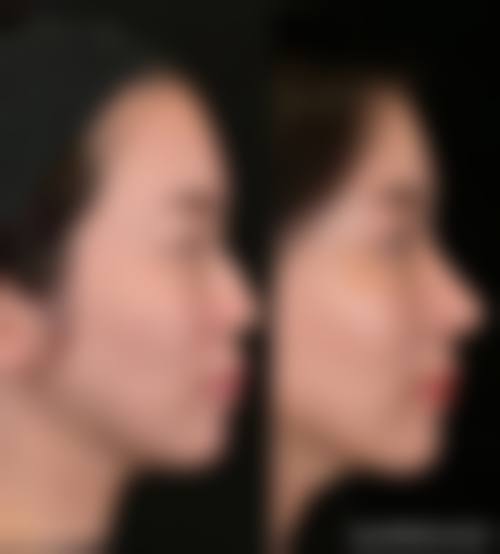 七、咸宁甜心医生医疗美容门诊部预约方式