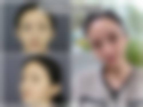 二、温州新世纪整形美容医院怎么样？