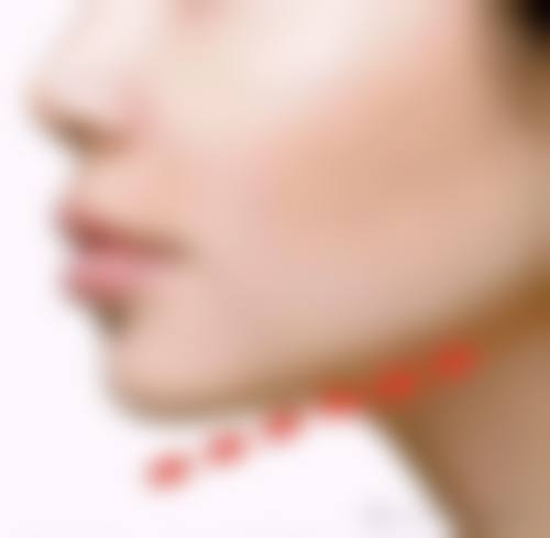 六、黄冈黄州皇氏整形医疗美容诊所价格表