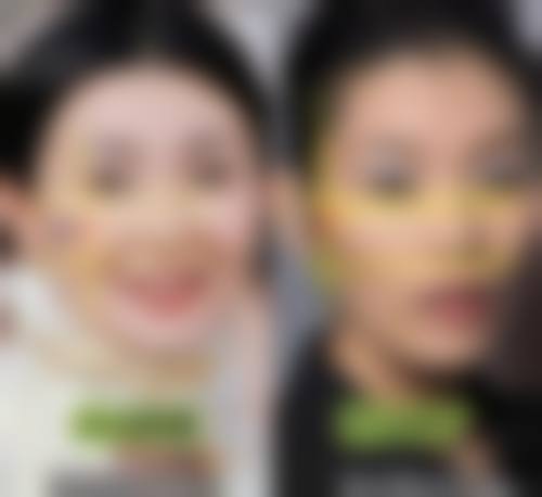 四、天津河西捷尔美整形特色项目