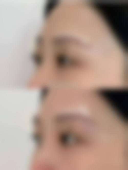 九、石家庄斯特恩医疗美容诊所真实的患者评价