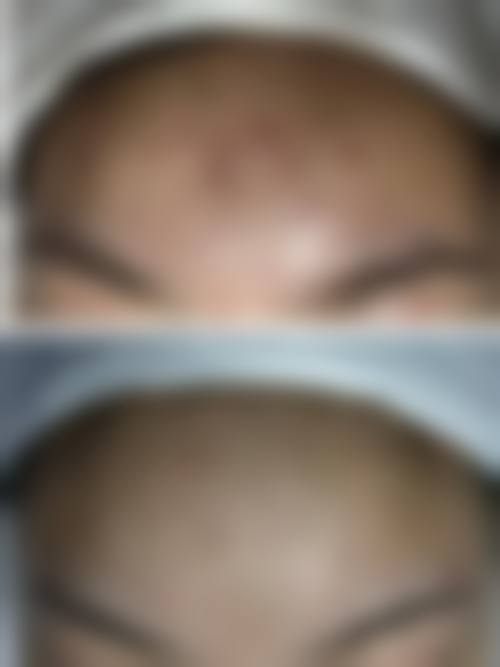 四、河北邢台媚思嘉医疗美容门诊特色项目