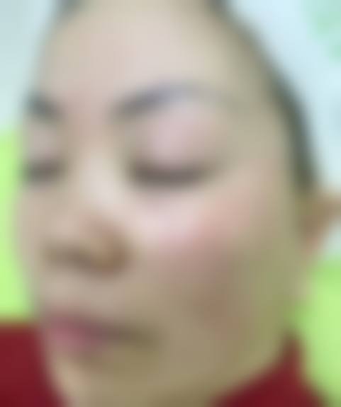 二、中山壹莱美医疗美容诊所怎么样？