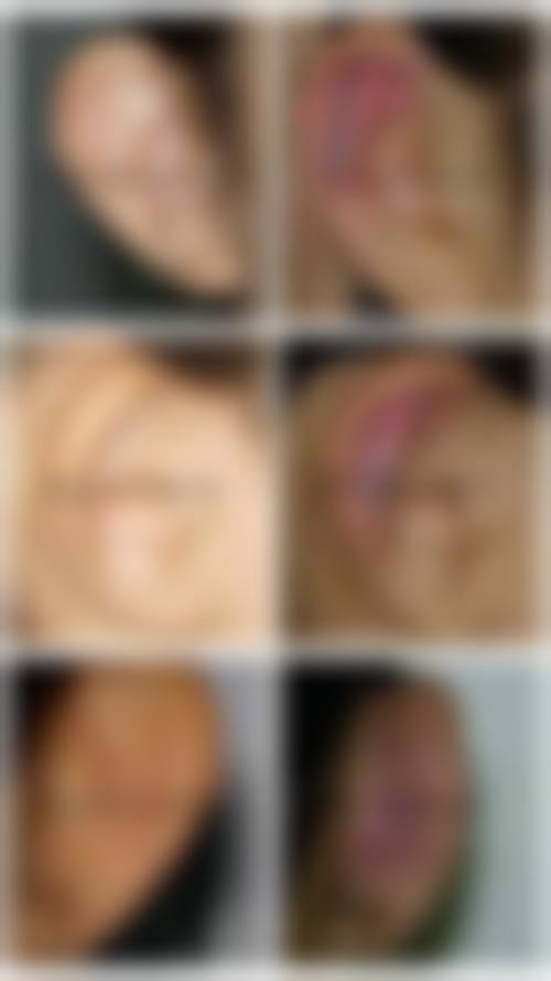 八、中山壹莱美医疗美容诊所真实的患者评价