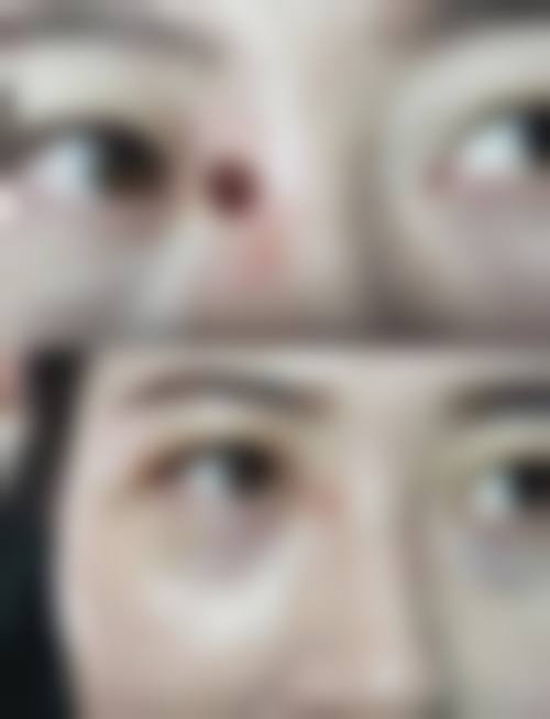 四、北京韩成美医疗美容诊所特色项目