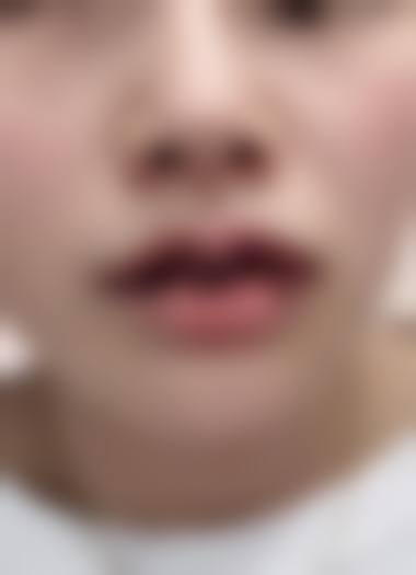 四、石家庄斯特恩医疗美容诊所特色项目