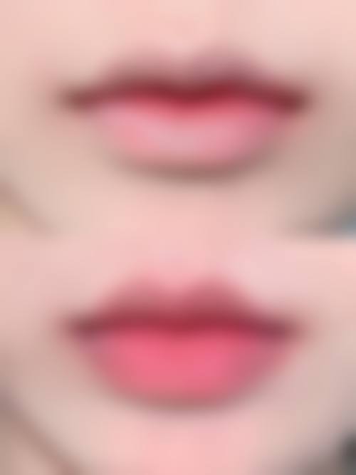 九、黄冈黄州皇氏整形医疗美容诊所真实的患者评价