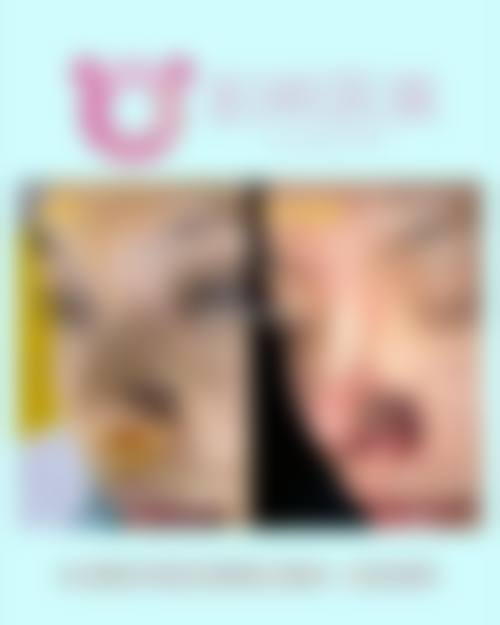 七、呼和浩特韩赋医疗美容预约方式