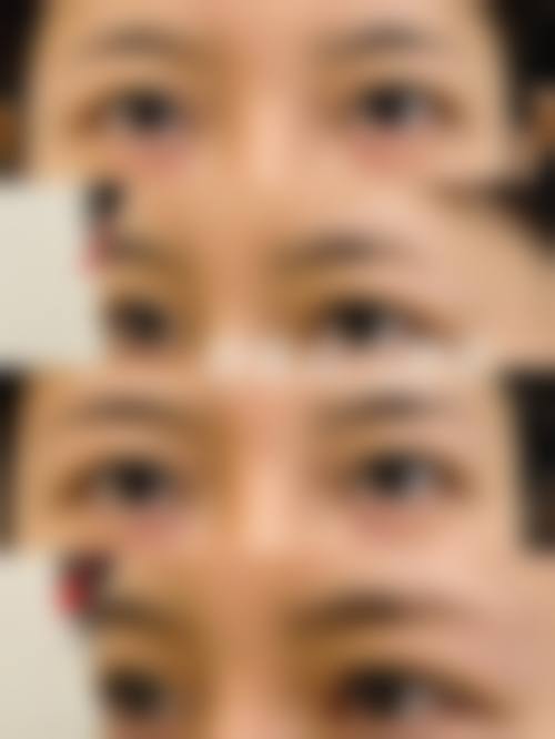 九、韩国yujinseu皮肤科医院真实的患者评价