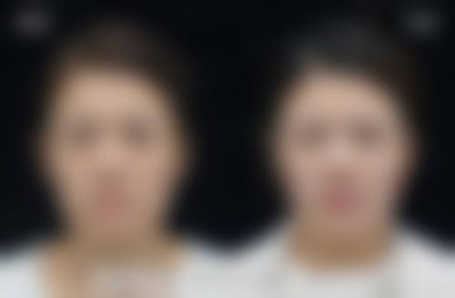 五、天津河西捷尔美整形价格表