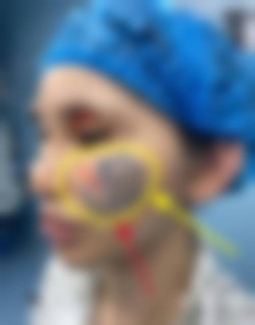 八、天津河西捷尔美整形真实的患者评价