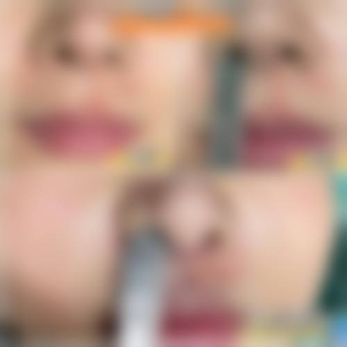 三、黄冈黄州皇氏整形医疗美容诊所诊疗项目有哪些？