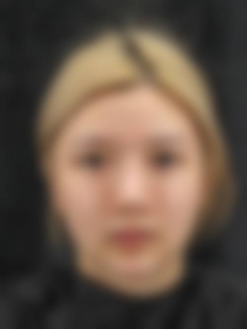 五、咸宁甜心医生医疗美容门诊部价格表