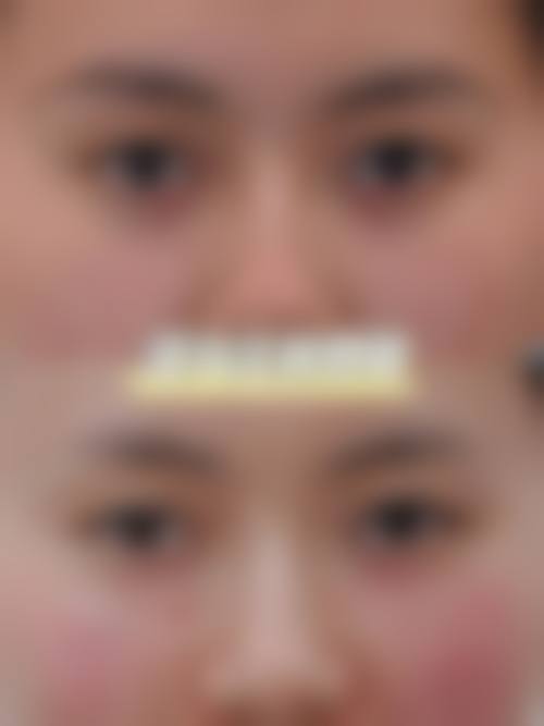 四、兴义市人民医院（医学美容科）特色项目