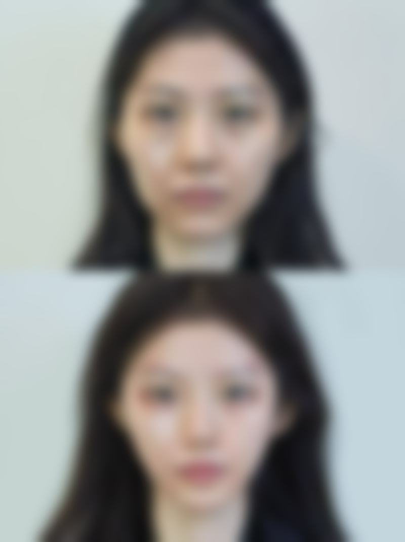 八、呼和浩特韩赋医疗美容真实的患者评价