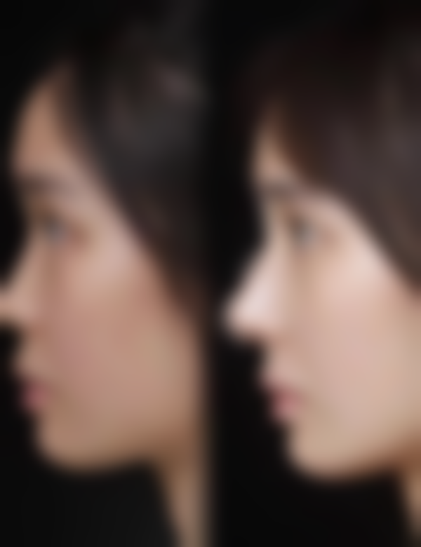 二、咸宁甜心医生医疗美容门诊部怎么样？