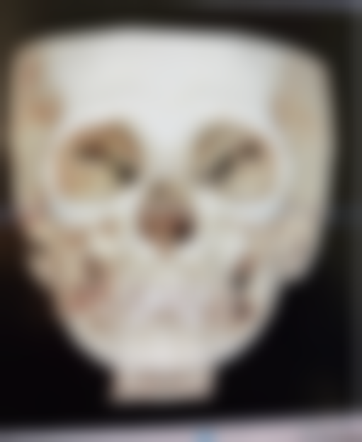 男士隆鼻有必要吗？知乎热议，多维度剖析男士隆鼻的必要性与风险提示